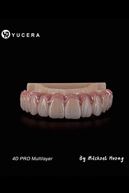 Latest company case about Case Share