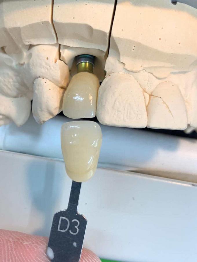 ST Preshade Dental Zirconia Disc 71mm Dental Cad Cam Milling System