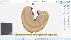 Mastering the YRC-S03 Intraoral Scanner: Step-by-Step Tutorial!