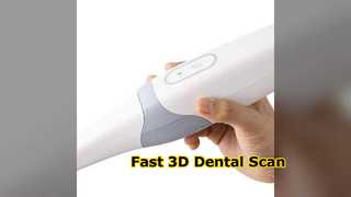 Yucera Dental Scanner Fast 3D Scan