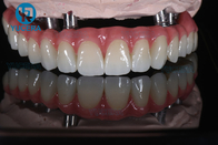 Dental 3D Multilayer Zirconia Block For Dental Esthetic Restoration