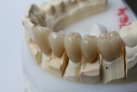 43%  Translucent 1100Mpa Dental Zirconia Block Adhesive No Irritation