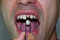 C14 LT HT Dental Zirconia Block Emax Lithium Disilicate Block