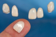 I12 C14 B40 Translucent Zirconia Blocks For Dental Lab Cadcam Veneer