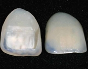 Yucera Dental HT LT Lithium Disilicate Blocks For Anterior Crown Veneer