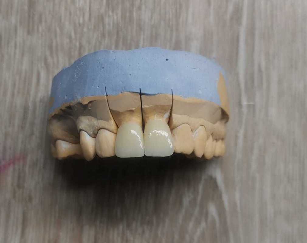 Yucera Dental Laboratory Zirconia Blank Cad Cam ST Color A1/a2/a3 Color Dental Zirconia Block