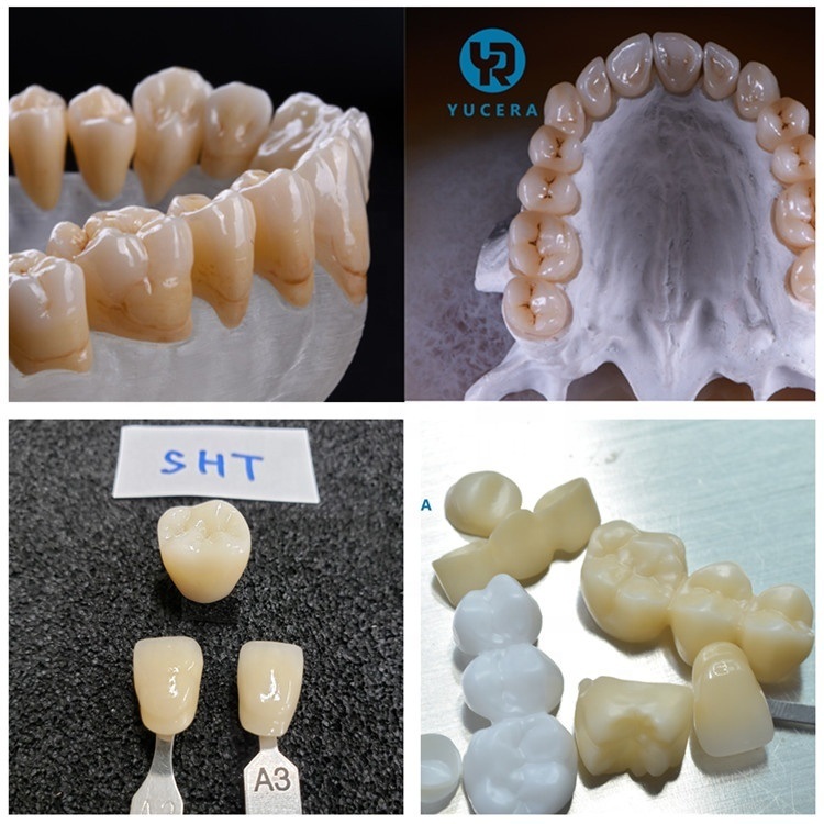 Yucera Dental SHT Zirconia Ceramic Multilayers Dental Zirconia Block Materials 95 mm