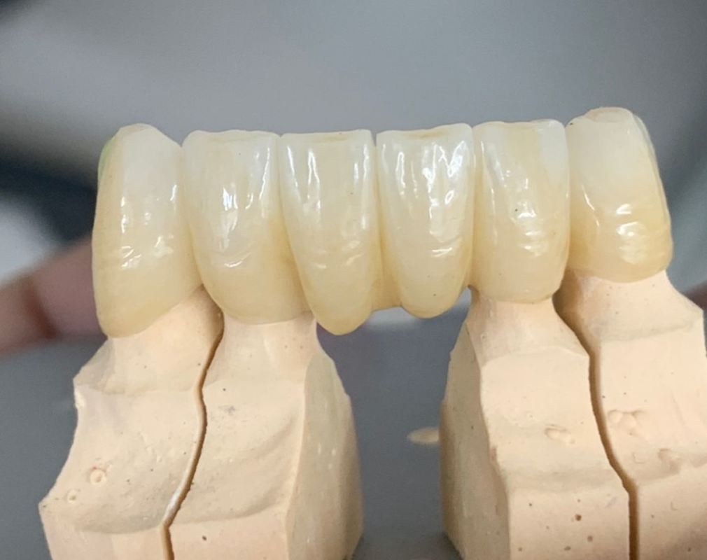 Zirconia Block 98 mm 3D Multilayer Yucera Dental Laboratory  Zirconio Multilayer Dentale Zirconia Block CAD CAM