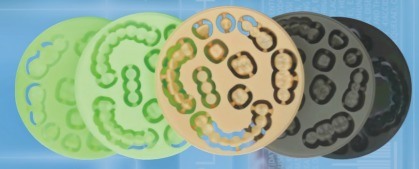 Yucera Dental Materials Pmma (resin Discs) Block Zirconia Discs for Excellent Aesthetic Restorations