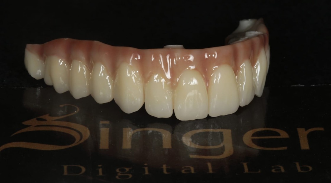 Yucera 4D Pro Dental - Specific Zirconia Ceramic Block with HT Plus Technology Improving the Quality of Restorations
