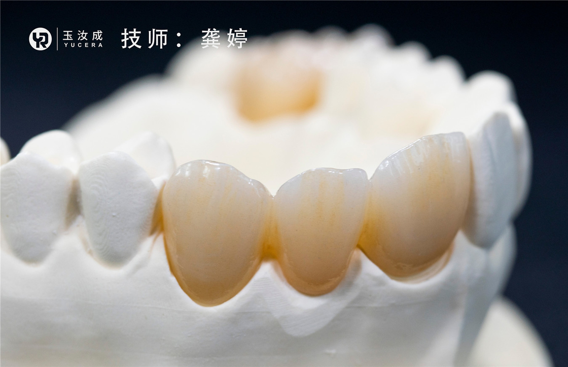 Yucera 3D Plus Multilaer Zirconia Block 98x16mm Open System For Posterior Crown