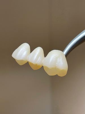 Dental Lab CAD CAM Super Translucent Zirconia Block Dioxide Zirconium ...